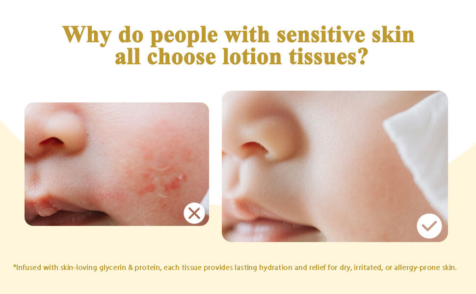 why people with sensitive skin choose lotion tissues infused with glycerin and protein lasting hydration for dry irritated allergy-prone skin